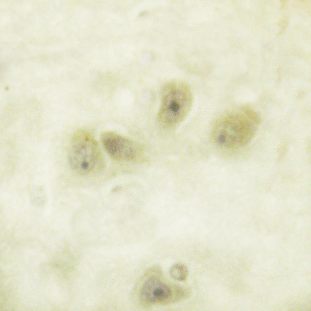 GFAP Antibody - 1/100 staining human brain tissue by IHC-P. The sample was formaldehyde fixed and a heat mediated antigen retrieval step in citrate buffer was performed. The sample was then blocked and incubated with the antibody for 1.5 hours at 22°C. An HRP conjugated goat anti-rabbit antibody was used as the secondary antibody.