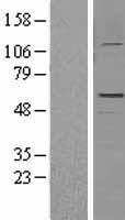 GFAP Protein - Western validation with an anti-DDK antibody * L: Control HEK293 lysate R: Over-expression lysate