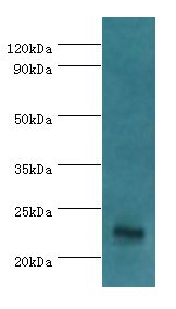 GFER Antibody - Western blot. All lanes: GFER antibody at 3 ug/ml+mouse liver tissue. Secondary antibody: Goat polyclonal to rabbit at 1:10000 dilution. Predicted band size: 23 kDa. Observed band size: 23 kDa.