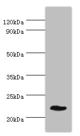 GFER Antibody - Western blot All lanes: GFER antibody at 3µg/ml + Mouse liver tissue Secondary Goat polyclonal to rabbit IgG at 1/10000 dilution Predicted band size: 24, 16 kDa Observed band size: 24 kDa