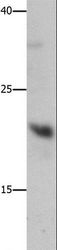 GFER Antibody - Western blot analysis of Mouse liver tissue, using GFER Polyclonal Antibody at dilution of 1:750.