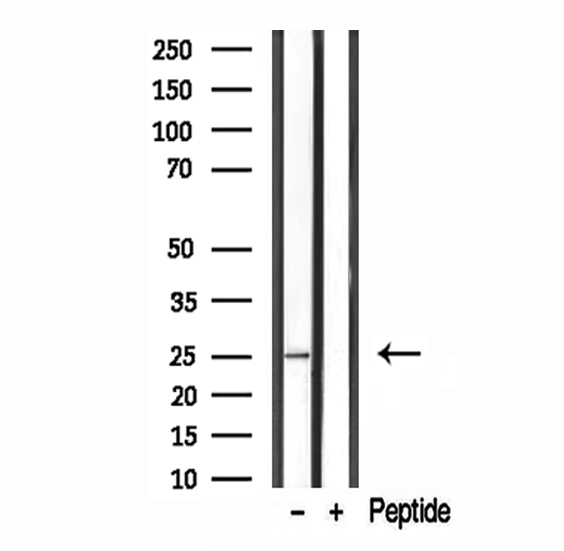 GFER Antibody - Western blot analysis of extracts of A375 cells using ALR antibody.