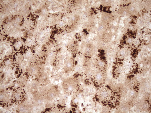 GFI1 Antibody - Immunohistochemical staining of paraffin-embedded Human liver tissue within the normal limits using anti-GFI1 mouse monoclonal antibody. (Heat-induced epitope retrieval by 1 mM EDTA in 10mM Tris, pH8.5, 120C for 3min,