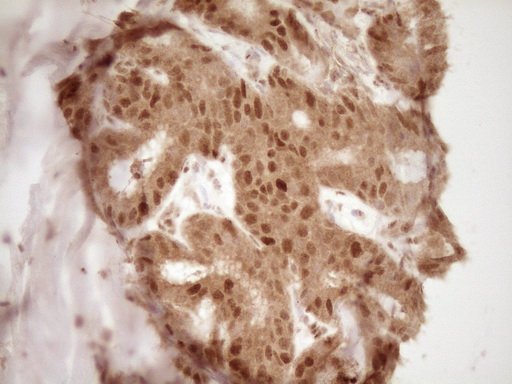 GFI1 Antibody - IHC of paraffin-embedded Human colon tissue using anti-GFI1 mouse monoclonal antibody. (Heat-induced epitope retrieval by 1 mM EDTA in 10mM Tris, pH8.5, 120°C for 3min).