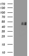 GFI1 Antibody - HEK293T cells were transfected with the pCMV6-ENTRY control. (Left lane) or pCMV6-ENTRY GFI1. (Right lane) cDNA for 48 hrs and lysed. Equivalent amounts of cell lysates. (5 ug per lane) were separated by SDS-PAGE and immunoblotted with anti-GFI1.