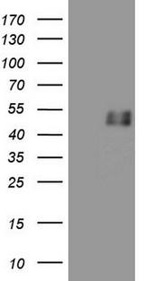 GFI1 Antibody - HEK293T cells were transfected with the pCMV6-ENTRY control (Left lane) or pCMV6-ENTRY GFI1 (Right lane) cDNA for 48 hrs and lysed. Equivalent amounts of cell lysates (5 ug per lane) were separated by SDS-PAGE and immunoblotted with anti-GFI1.