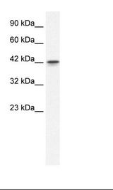 GFI1B Antibody - Jurkat Cell Lysate.  This image was taken for the unconjugated form of this product. Other forms have not been tested.