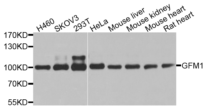 GFM1 Antibody - Western blot analysis of extracts of various cell lines.