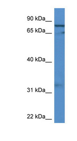 GFM2 Antibody - GFM2 antibody Western blot of MCF7 cell lysate.  This image was taken for the unconjugated form of this product. Other forms have not been tested.