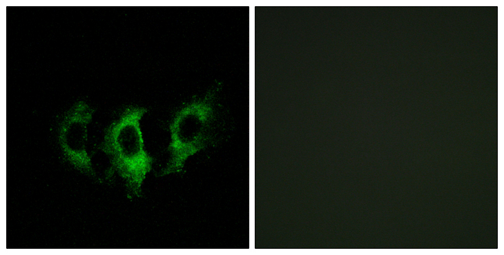 GFM2 Antibody - Immunofluorescence analysis of A549 cells, using GFM2 Antibody. The picture on the right is blocked with the synthesized peptide.