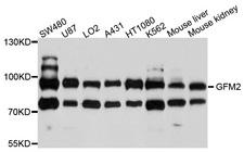 GFM2 Antibody - Western blot analysis of extracts of various cell lines, using GFM2 antibody at 1:1000 dilution. The secondary antibody used was an HRP Goat Anti-Rabbit IgG (H+L) at 1:10000 dilution. Lysates were loaded 25ug per lane and 3% nonfat dry milk in TBST was used for blocking. An ECL Kit was used for detection and the exposure time was 10s.