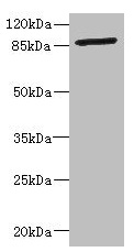 GFM2 Antibody - Western blot All lanes: GFM2 antibody at 3.24µg/ml + Jurkat whole cell lysate Secondary Goat polyclonal to rabbit IgG at 1/10000 dilution Predicted band size: 87, 82, 68, 58 kDa Observed band size: 87 kDa
