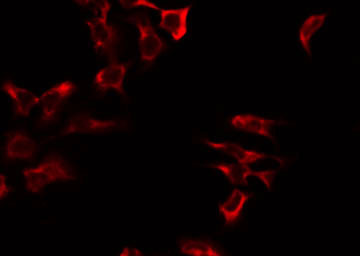 GFM2 Antibody - Staining LOVO cells by IF/ICC. The samples were fixed with PFA and permeabilized in 0.1% Triton X-100, then blocked in 10% serum for 45 min at 25°C. The primary antibody was diluted at 1:200 and incubated with the sample for 1 hour at 37°C. An Alexa Fluor 594 conjugated goat anti-rabbit IgG (H+L) Ab, diluted at 1/600, was used as the secondary antibody.
