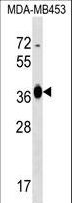 GFOD2 Antibody - GFOD2 Antibody western blot of MDA-MB453 cell line lysates (35 ug/lane). The GFOD2 antibody detected the GFOD2 protein (arrow).