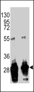 GFP Tag Antibody - Western blot of anti-GFP Tag Antibody (Ascites) (CA071114E) in GFP recombinant protein. GFP recombinant protein (arrow) was detected using the purified antibody.