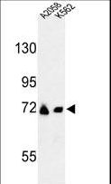 GFPT2 Antibody - Western blot of GFPT2 Antibody in A2058, K562 cell line lysates (35 ug/lane). GFPT2 (arrow) was detected using the purified antibody.