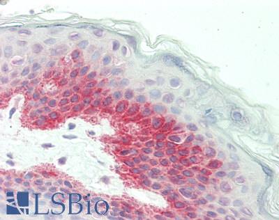 GFPT2 Antibody - Human Skin: Formalin-Fixed, Paraffin-Embedded (FFPE).  This image was taken for the unconjugated form of this product. Other forms have not been tested.