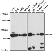 GFPT2 Antibody - Western blot analysis of extracts of various cell lines, using GFPT2 antibody at 1:1000 dilution. The secondary antibody used was an HRP Goat Anti-Rabbit IgG (H+L) at 1:10000 dilution. Lysates were loaded 25ug per lane and 3% nonfat dry milk in TBST was used for blocking. An ECL Kit was used for detection and the exposure time was 3s.