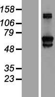 GFPT2 Protein - Western validation with an anti-DDK antibody * L: Control HEK293 lysate R: Over-expression lysate