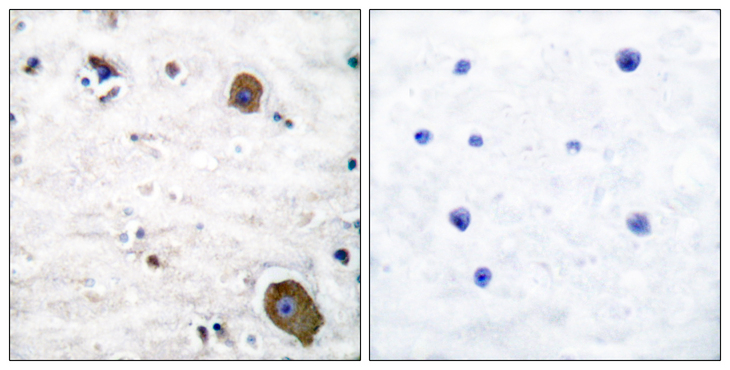 GFRA1 / GFR Alpha Antibody - Immunohistochemistry analysis of paraffin-embedded human brain tissue, using GFR alpha-1 Antibody. The picture on the right is blocked with the synthesized peptide.