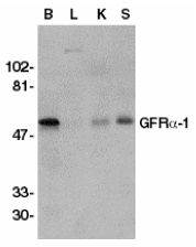 GFRA1 / GFR Alpha Antibody - Western blot of GFRa-1 in crude membrane fractions of human brain (B), liver (L), kidney (K), and spleen (S), respectively, with GFRa-1 antibody at 1 ug/ml dilution.