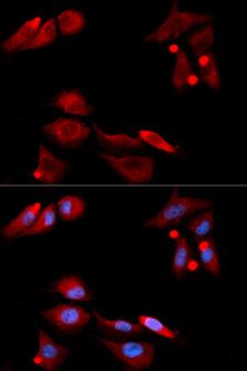 GFRA1 / GFR Alpha Antibody - Immunofluorescence analysis of U20S cell using GFRA1 antibody. Blue: DAPI for nuclear staining.