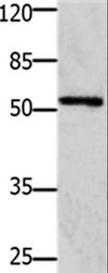 GFRA1 / GFR Alpha Antibody - Western blot analysis of 293T cell, using GFRA1 Polyclonal Antibody at dilution of 1:1250.