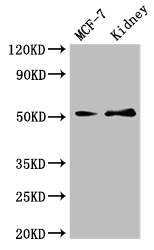GFRA1 / GFR Alpha Antibody - Positive WB detected in:MCF-7 whole cell lysate,Mouse kidney tissue;All lanes:GFRA1 antibody at 3ug/ml;Secondary;Goat polyclonal to rabbit IgG at 1/50000 dilution;Predicted band size: 52,51 kDa;Observed band size: 52 kDa;