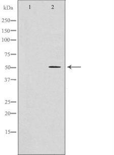 GFRA1 / GFR Alpha Antibody - Western blot analysis of mouse kidney lysate using GFRA1 antibody. The lane on the left is treated with the antigen-specific peptide.