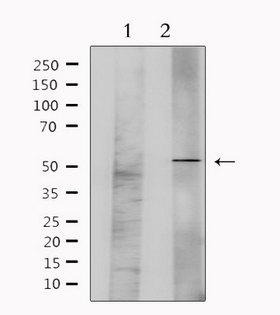 GFRA1 / GFR Alpha Antibody - Western blot analysis of extracts of mouse brain tissue using GFRA1 antibody. Lane 1 was treated with the antigen-specific peptide.