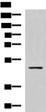 GFRA1 / GFR Alpha Antibody - Western blot analysis of Rat brain tissue lysate  using GFRA1 Polyclonal Antibody at dilution of 1:800