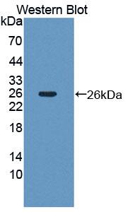GFRA2 Antibody - Western blot of GFRA2 antibody.