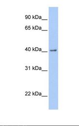 GFRA2 Antibody - Fetal brain lysate. Antibody concentration: 1.0 ug/ml. Gel concentration: 12%.  This image was taken for the unconjugated form of this product. Other forms have not been tested.