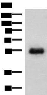 GFRA2 Antibody - Western blot analysis of Human placenta tissue lysate  using GFRA2 Polyclonal Antibody at dilution of 1:400