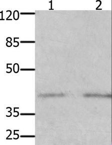 GFRA3 Antibody - Western blot analysis of Human fetal kidney and brain tissue, using GFRA3 Polyclonal Antibody at dilution of 1:1000.