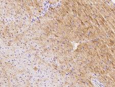 GFRA3 Antibody - Immunochemical staining GFRA3 in mouse heart with rabbit polyclonal antibody at 1:500 dilution, formalin-fixed paraffin embedded sections.
