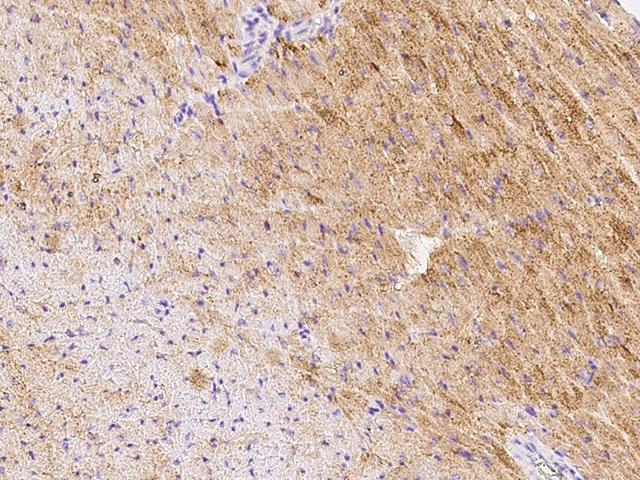 GFRA3 Antibody - Immunochemical staining GFRA3 in mouse heart with rabbit polyclonal antibody at 1:500 dilution, formalin-fixed paraffin embedded sections.