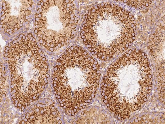 GFRA3 Antibody - Immunochemical staining GFRA3 in mouse testis with rabbit polyclonal antibody at 1:500 dilution, formalin-fixed paraffin embedded sections.