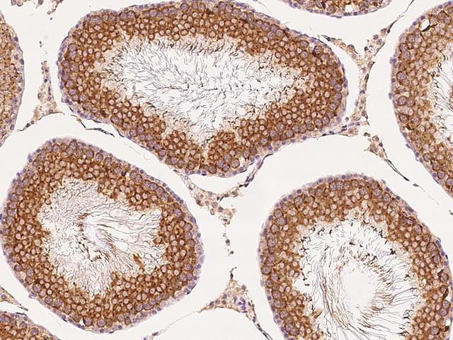 GFRA3 Antibody - Immunochemical staining GFRA3 in rat testis with rabbit polyclonal antibody at 1:500 dilution, formalin-fixed paraffin embedded sections.