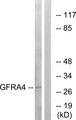GFRA4 Antibody - Western blot analysis of lysates from HeLa cells, using GFRA4 Antibody. The lane on the right is blocked with the synthesized peptide.