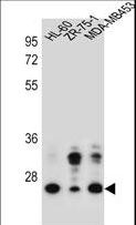 GFRA4 Antibody - GFRA4 Antibody western blot of HL-60,ZR-75-1,MDA-MB453 cell line lysates (35 ug/lane). The GFRA4 antibody detected the GFRA4 protein (arrow).