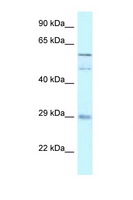 GFRA4 Antibody - GFRA4 antibody Western blot of 721_B Cell lysate. Antibody concentration 1 ug/ml.  This image was taken for the unconjugated form of this product. Other forms have not been tested.