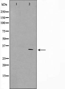 GFRA4 Antibody - Western blot analysis on HeLa cell lysates using GFRA4 antibody. The lane on the left is treated with the antigen-specific peptide.