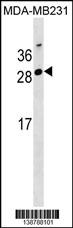 GG2L4 Antibody - GG2L4 Antibody (Center) western blot analysis in MDA-MB231 cell line lysates (35ug/lane).This demonstrates the GG2L4 antibody detected the GG2L4 protein (arrow).