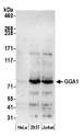 GGA1 Antibody - Detection of human GGA1 by western blot. Samples: Whole cell lysate (50 µg) from HeLa, HEK293T, and Jurkat cells prepared using NETN lysis buffer. Antibody: Affinity purified rabbit anti-GGA1 antibody used for WB at 0.1 µg/ml. Detection: Chemiluminescence with an exposure time of 3 minutes.