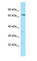 GGA1 Antibody - GGA1 antibody Western Blot of Jurkat.  This image was taken for the unconjugated form of this product. Other forms have not been tested.