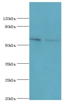 GGA2 Antibody - Western blot. All lanes: ADP-ribosylation factor-binding protein GGA2 antibody at 10 ug/ml. Lane 1: rat brain tissue. Lane 2: mouse liver tissue. Secondary antibody: Goat polyclonal to rabbit at 1:10000 dilution. Predicted band size: 67 kDa. Observed band size: 67 kDa Immunohistochemistry.