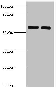 GGA2 Antibody - Western blot All lanes: ADP-ribosylation factor-binding protein GGA2 antibody at 10µg/ml Lane 1: Rat brain tissue Lane 2: Mouse liver tissue Secondary Goat polyclonal to rabbit IgG at 1/10000 dilution Predicted band size: 67 kDa Observed band size: 67 kDa