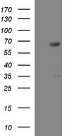 GGA2 Antibody - HEK293T cells were transfected with the pCMV6-ENTRY control (Left lane) or pCMV6-ENTRY GGA2 (Right lane) cDNA for 48 hrs and lysed. Equivalent amounts of cell lysates (5 ug per lane) were separated by SDS-PAGE and immunoblotted with anti-GGA2.