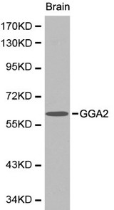 GGA2 Antibody - Western blot of GGA2 pAb in extracts from mouse brain tissue.